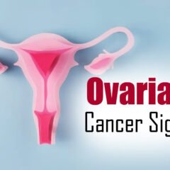 Recognizing the Signs: Ovarian Cancer vs PCOS and Endometriosis