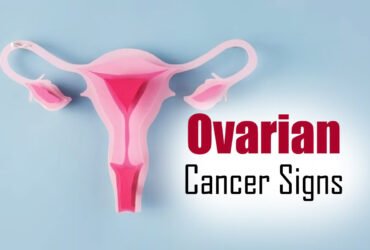 Recognizing the Signs Ovarian Cancer vs PCOS and Endometriosis Recognizing the Signs Ovarian Cancer vs PCOS and Endometriosis