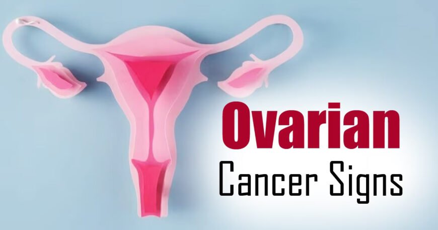 Recognizing the Signs Ovarian Cancer vs PCOS and Endometriosis